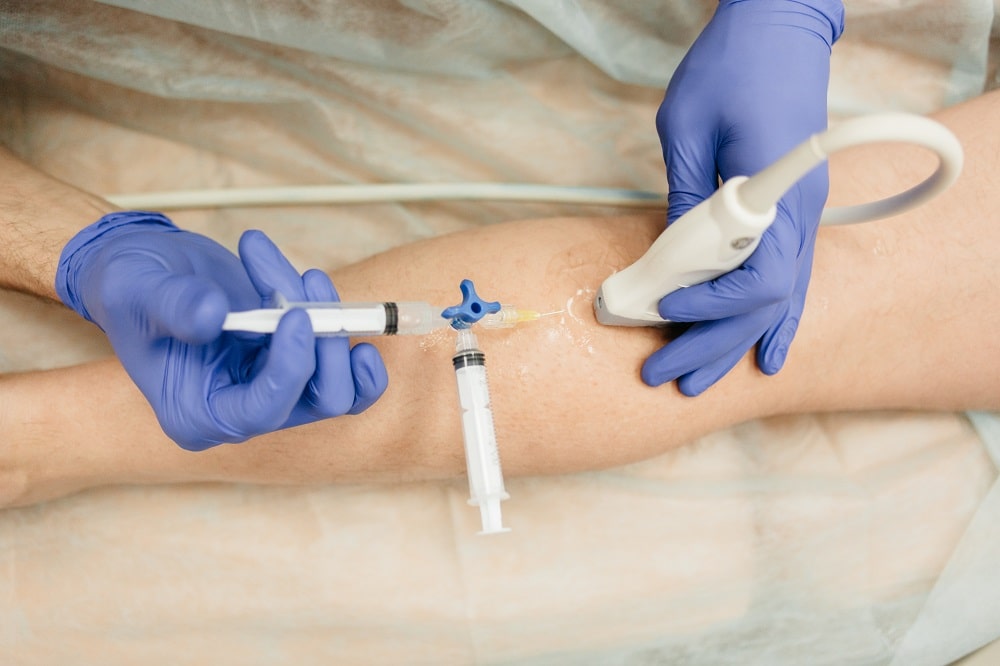 osobennosti-skleroterapii-pri-varikoze-foto-3.jpg osobennosti-skleroterapii-pri-varikoze-foto-3.jpg