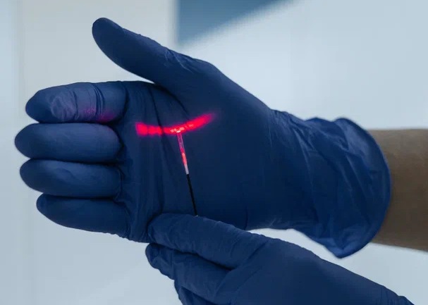 Удаление варикозных вен лазером