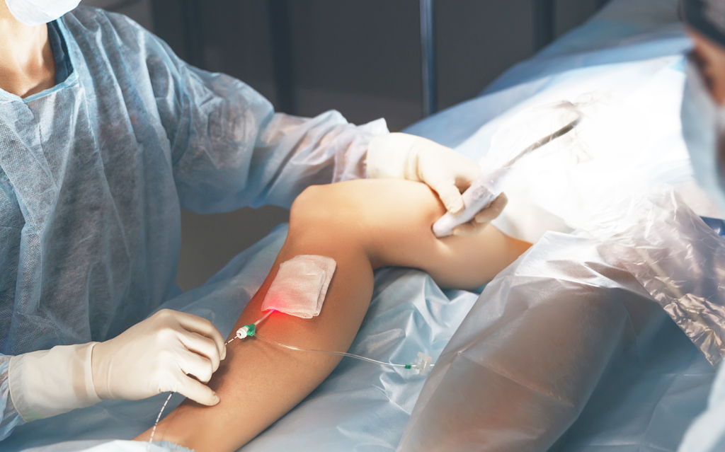 Лечение тромбоза глубоких вен