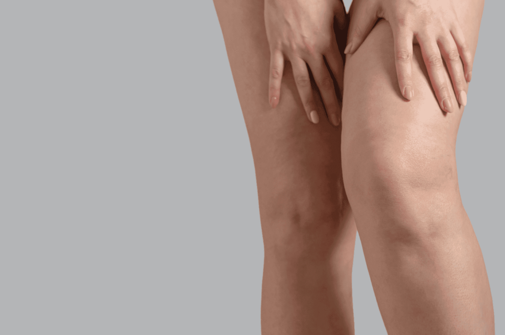 Здоровые вены